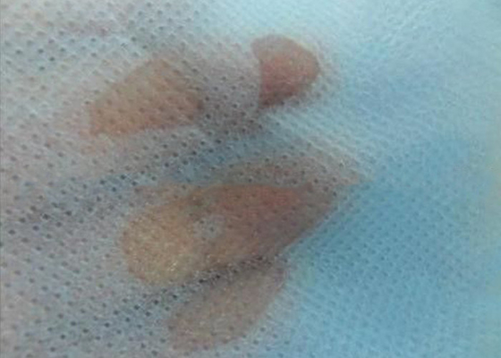 Mua Không độc hại SMS Không dệt Vải Eco - Thân thiện với nước Hydrophobic cho tã online manufacture